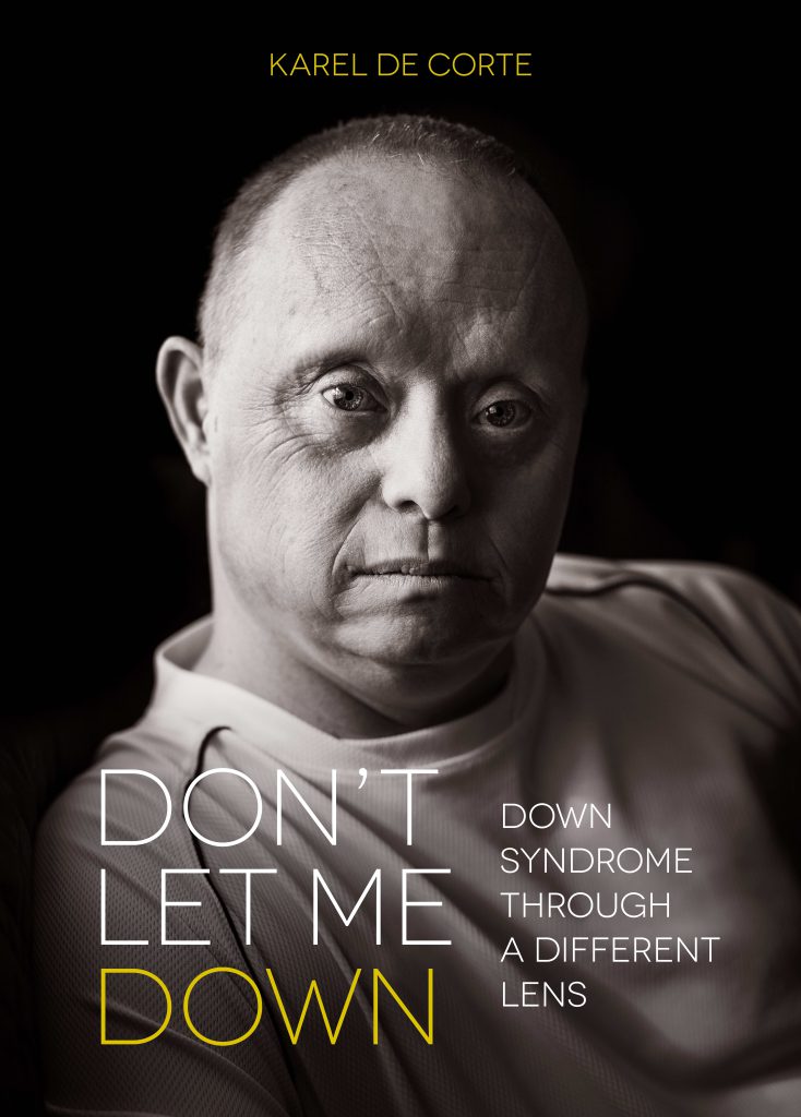 Don't let me Down. Down syndrome through a different lens